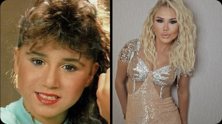 Ceylan’dan estetik itirafı: Yüzüm artık kaldırmıyor